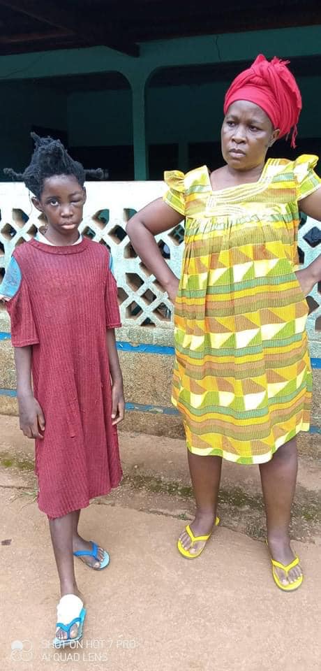 CAMEROUN :  ACCUSEE DE SORCELLERIE ET TORTUREE PENDANT SIX MOIS PAR SES PARENTS